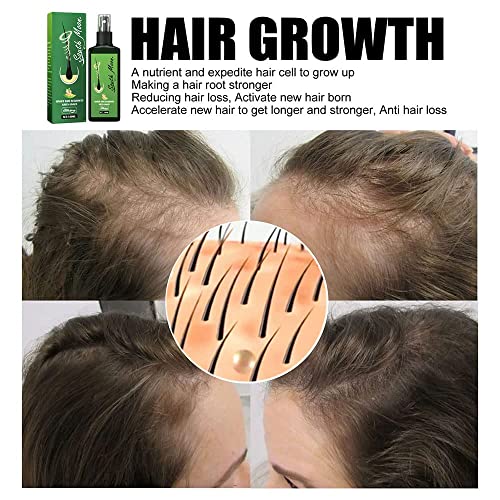 Подхранващ джинджифил спрей за коса, суроватка-спрей за растежа на косата с джинджифил за мъже и жени, органичен спрей за възстановяване