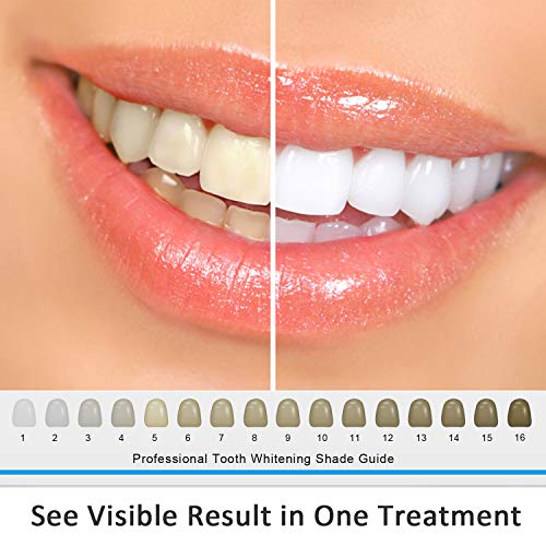 Комплект за избелване на зъбите MitButy с led подсветка, 22% разтвор на гел с бензоил пероксид (3x3 мл) и Тавата за устата - Избелване на зъби в домашни условия
